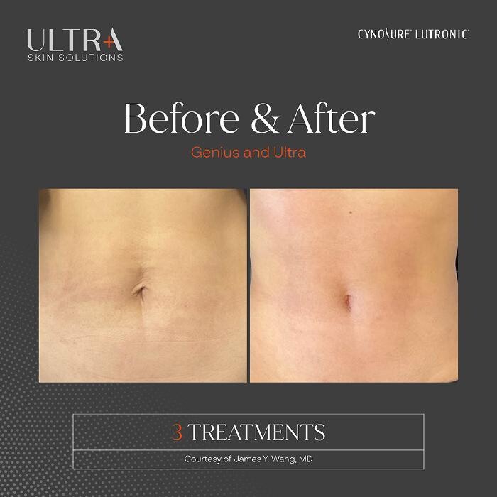 Images Central Oakville Skin Revitalization