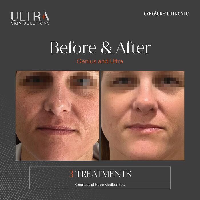 Images Central Oakville Skin Revitalization