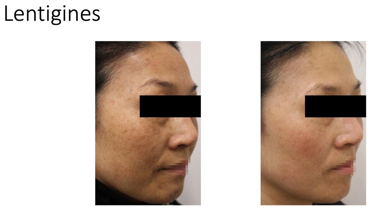 Images Central Oakville Skin Revitalization