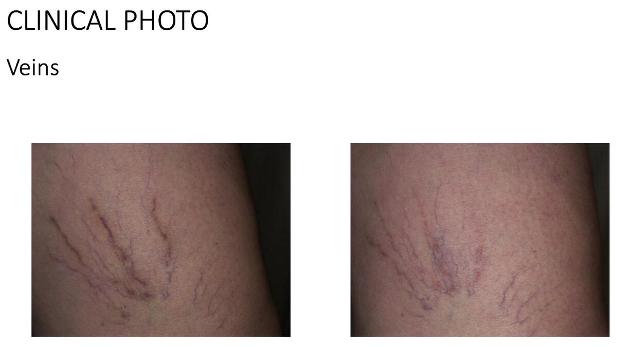 Images Central Oakville Skin Revitalization