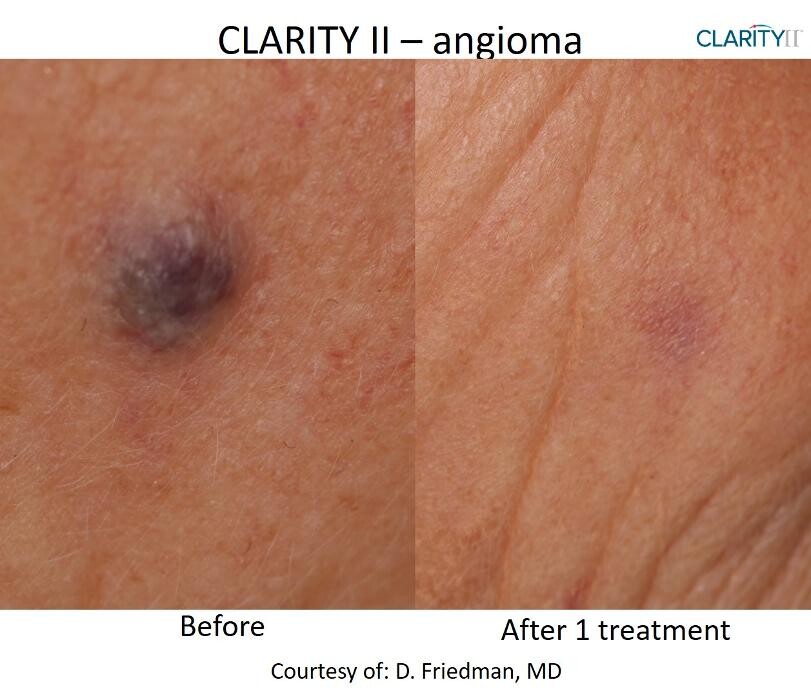 Images Central Oakville Skin Revitalization