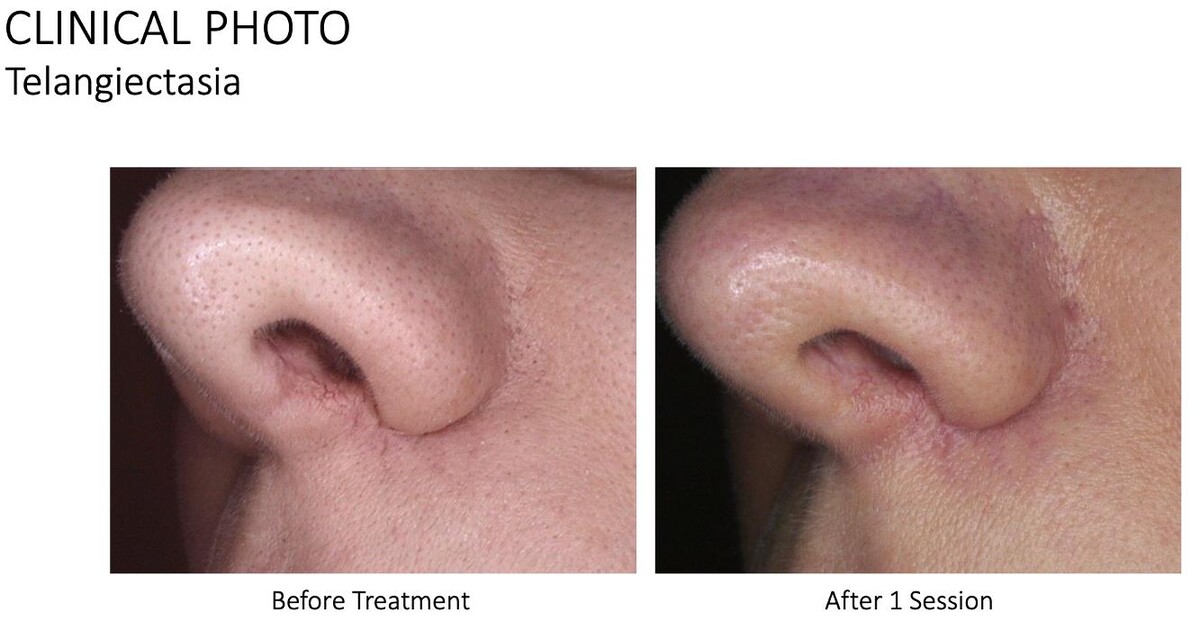 Images Central Oakville Skin Revitalization