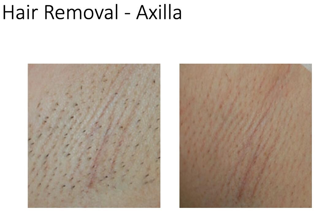 Images Central Oakville Skin Revitalization