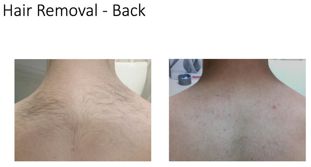 Images Central Oakville Skin Revitalization