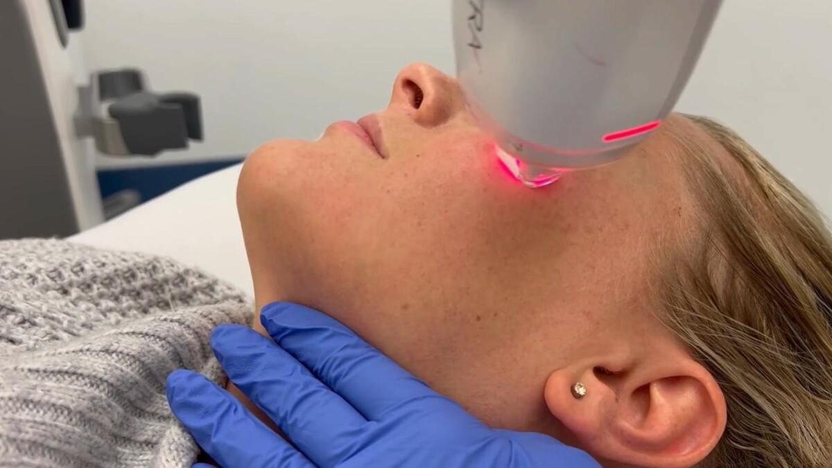 Images Central Oakville Skin Revitalization