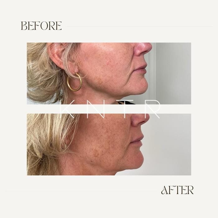 Images Kontour Medical Aesthetics
