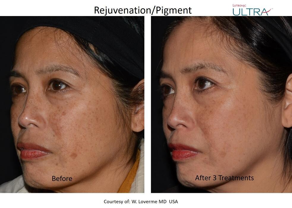 Images Komoka Skin x Aesthetics