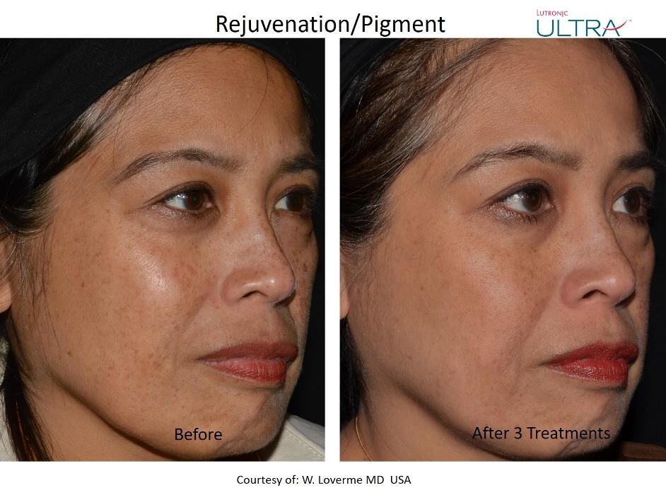Images Komoka Skin x Aesthetics