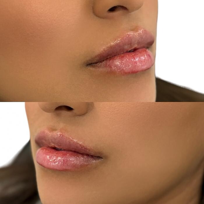 Images Cosmetic Nurse MB