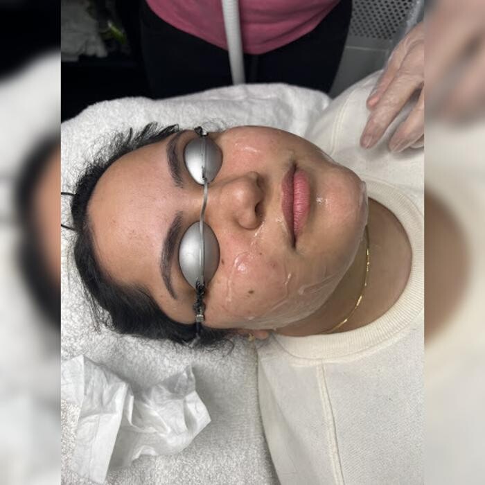 Images Glo Skin Care Clinic