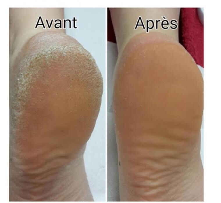 Images Pieds en Santé