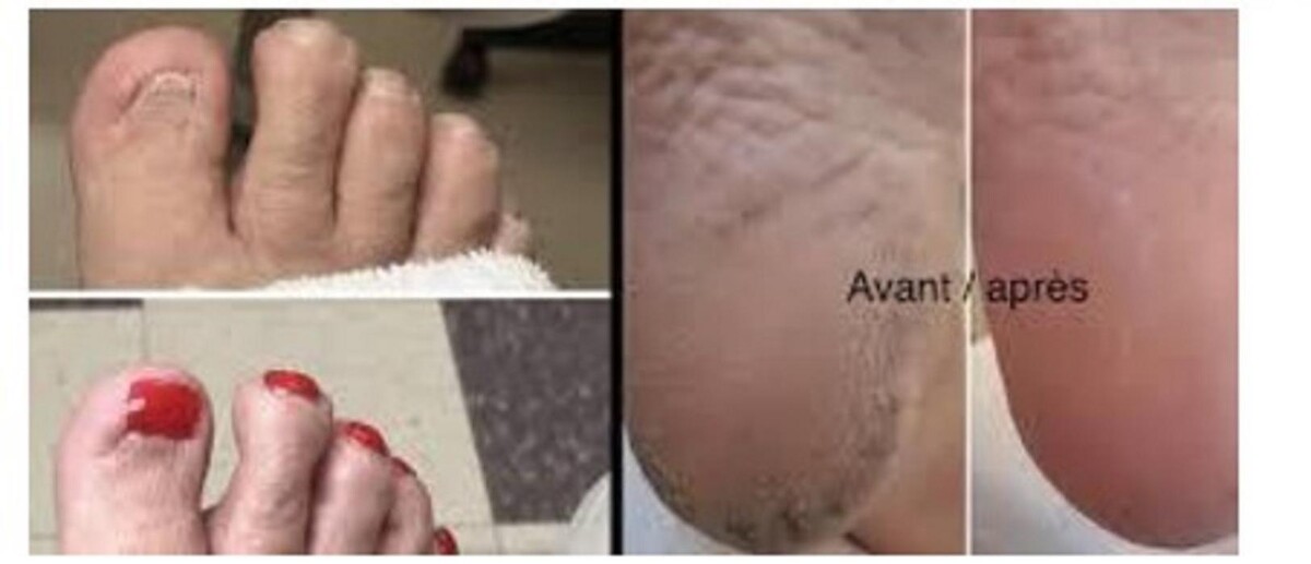 Images Pieds en Santé