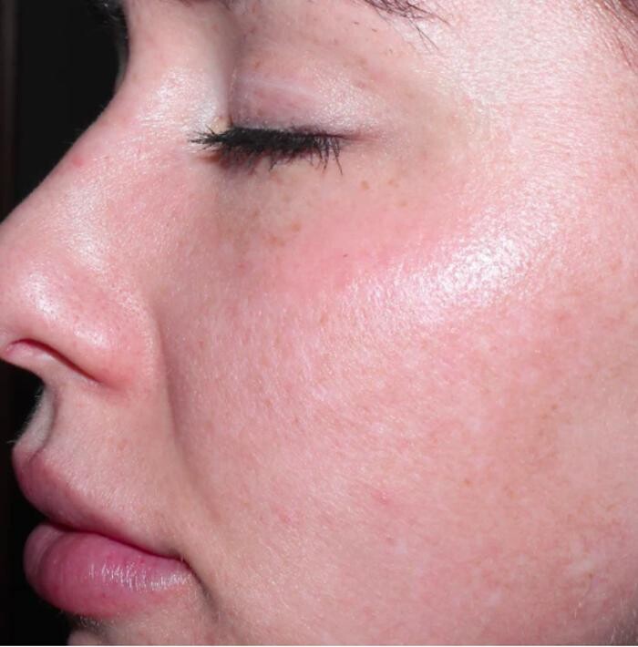 Images Merrion Medical Aesthetics