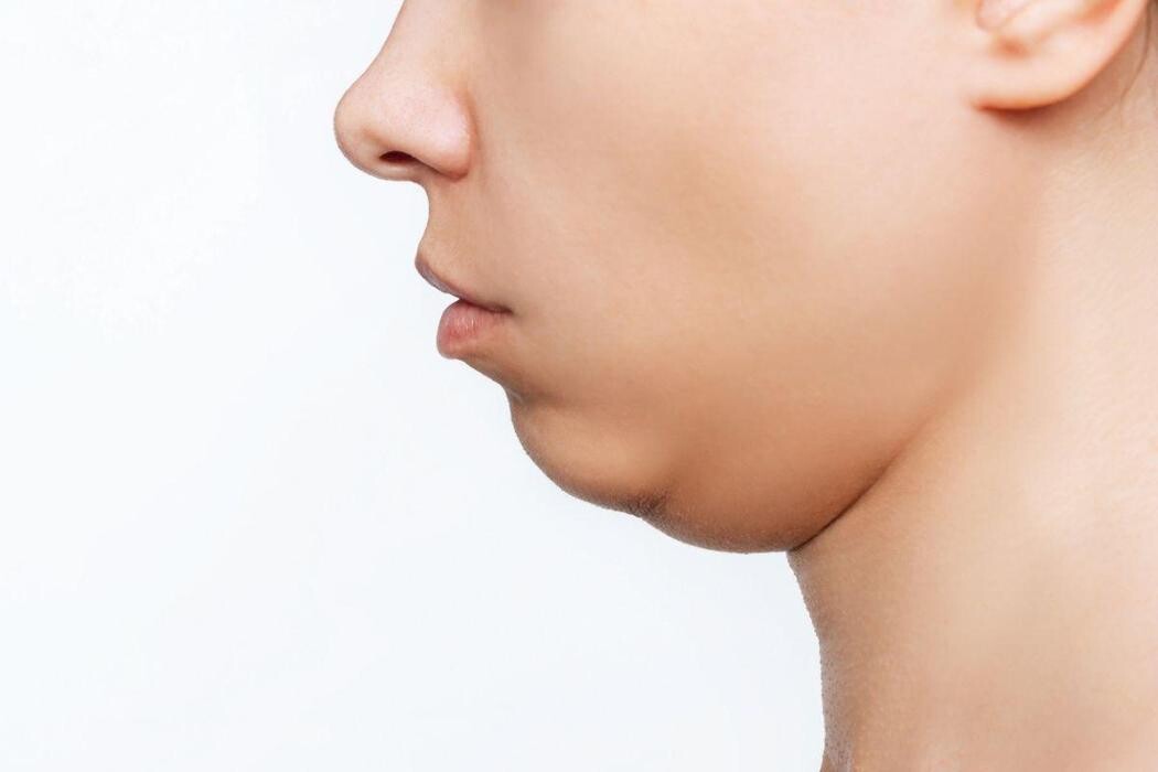 Images Merrion Medical Aesthetics