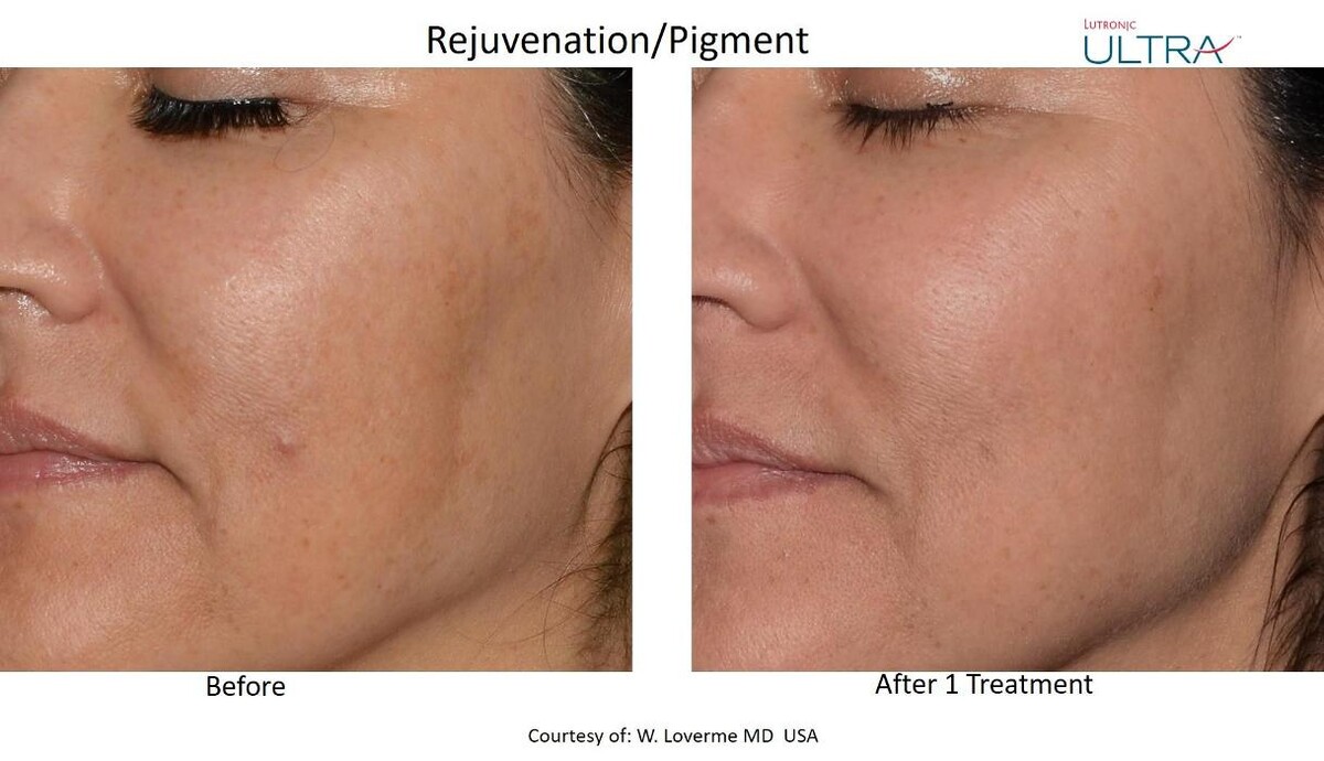 Images Merrion Medical Aesthetics