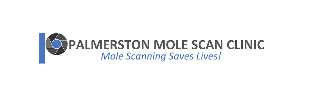 Images Palmerston Mole Scan Clinic
