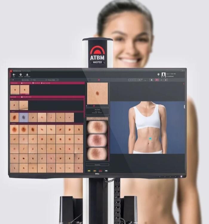 Images Palmerston Mole Scan Clinic