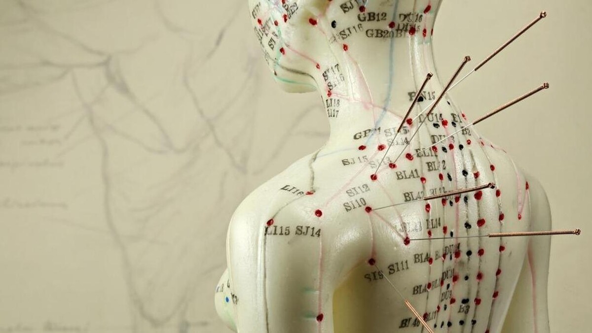 Images Balance Point Acupuncture and Integrative Medicine