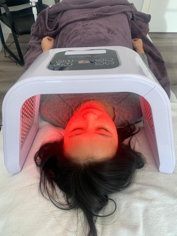 Images Balance Point Acupuncture and Integrative Medicine
