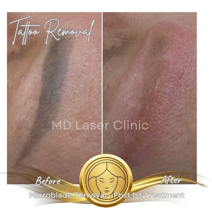 Images MD Laser Clinic