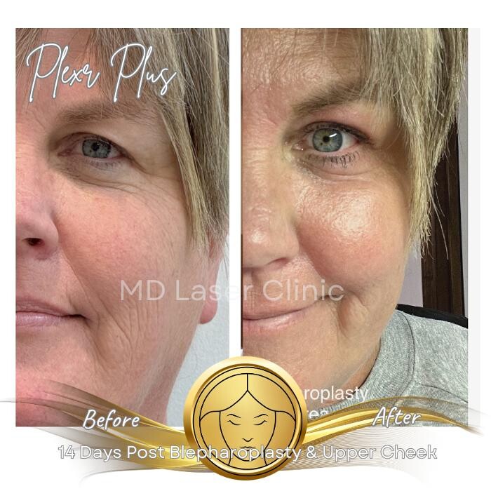 Images MD Laser Clinic