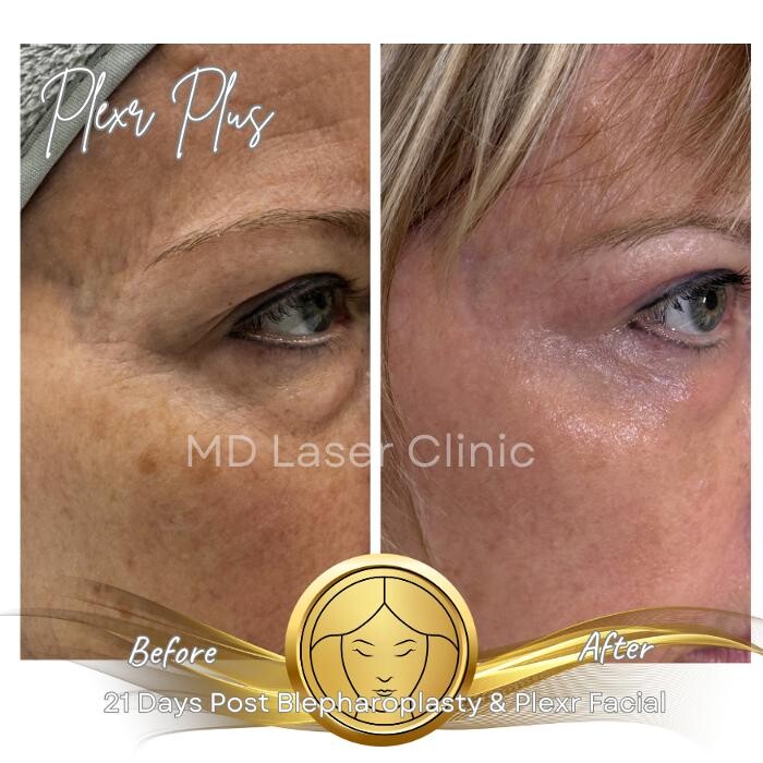 Images MD Laser Clinic
