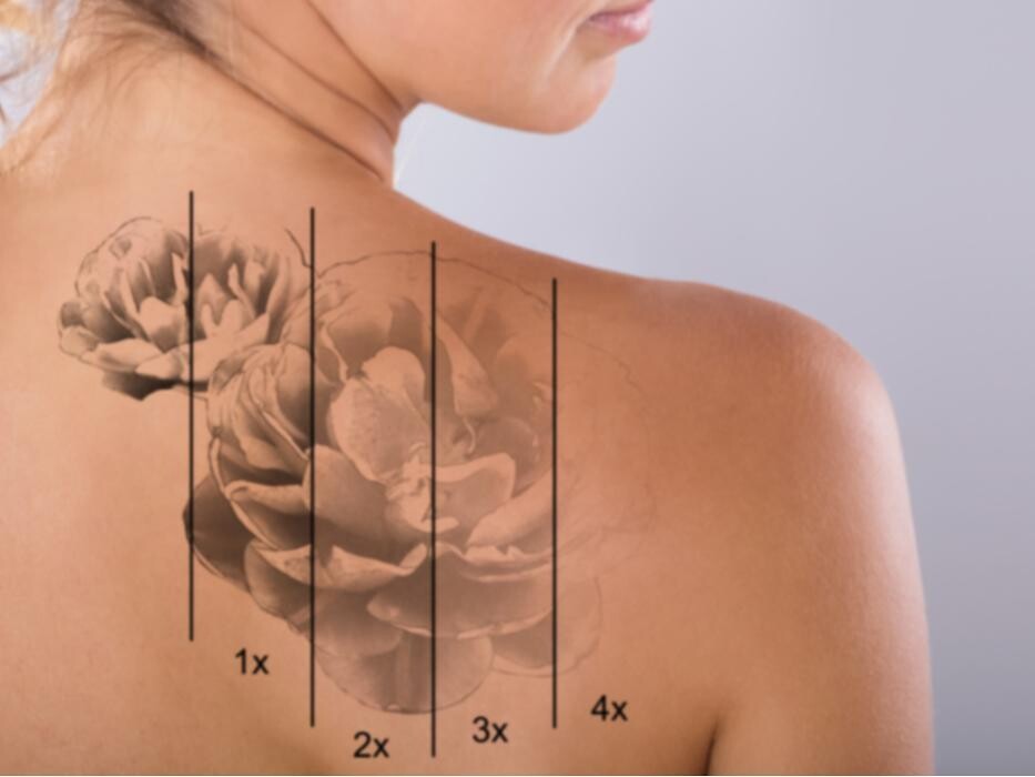 Images MD Laser Clinic