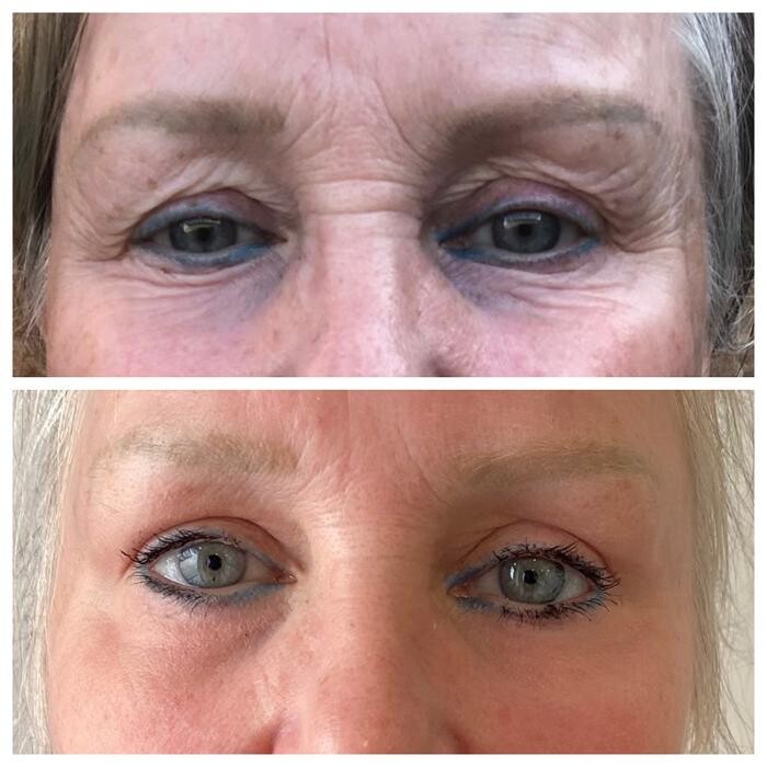 Images MD Laser Clinic
