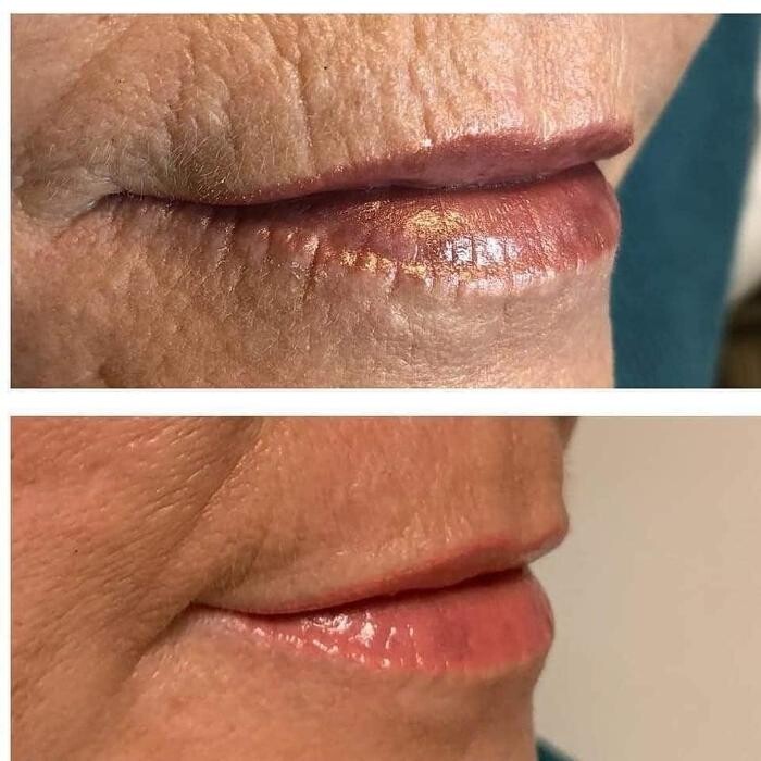 Images MD Laser Clinic