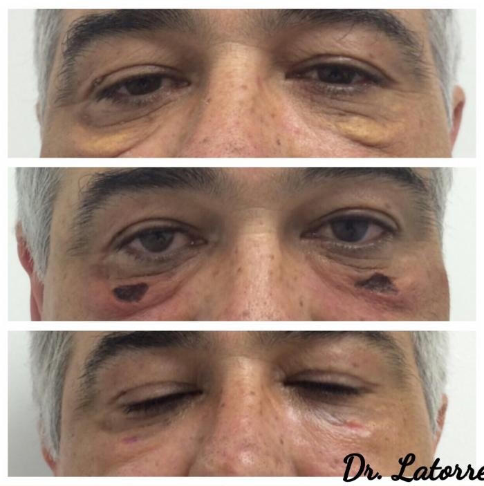Images MD Laser Clinic