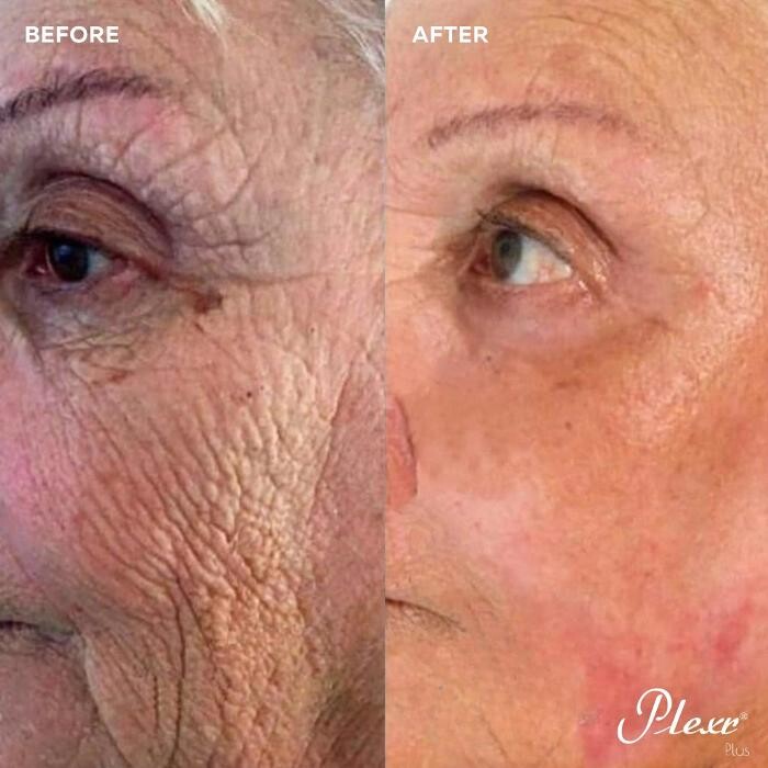 Images MD Laser Clinic