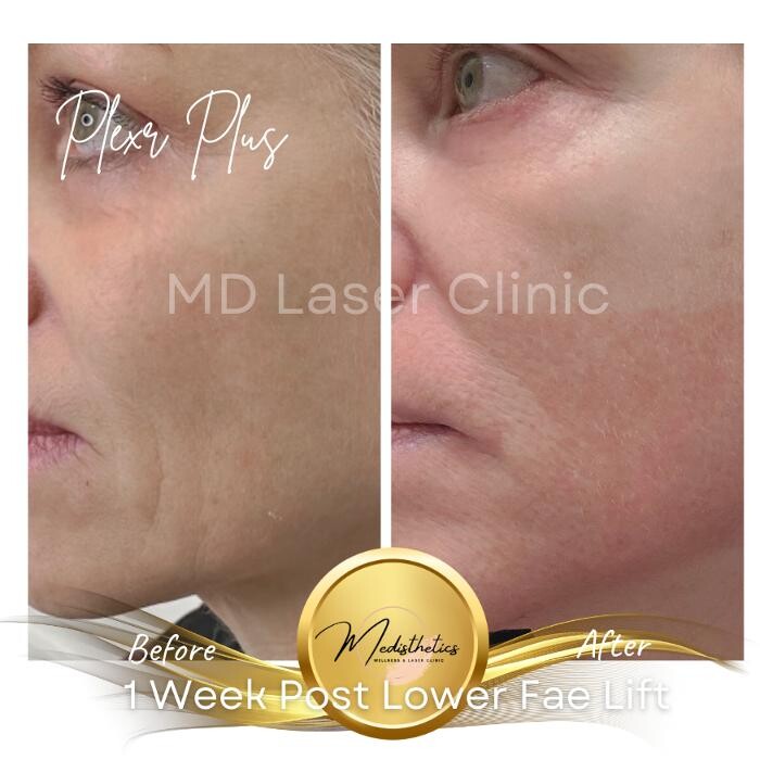 Images MD Laser Clinic