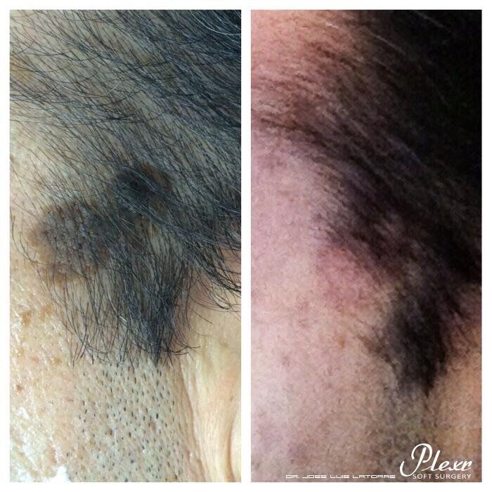 Images MD Laser Clinic