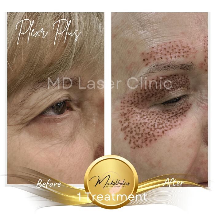 Images MD Laser Clinic
