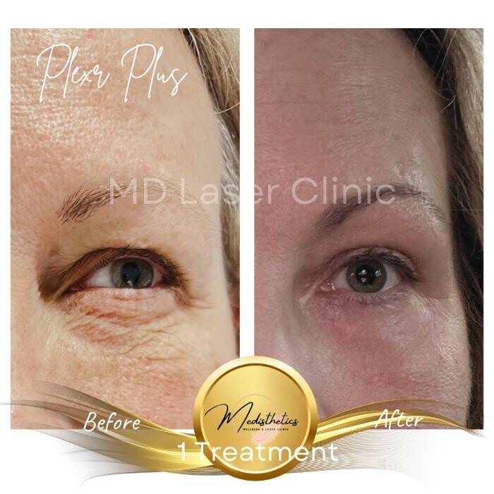 Images MD Laser Clinic