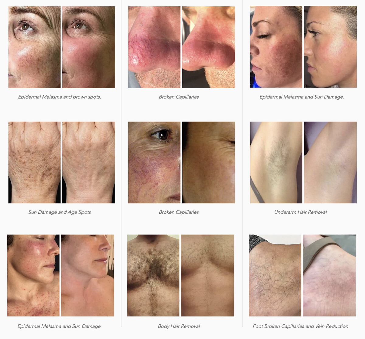 Images Lisse Laser & Skin Studio