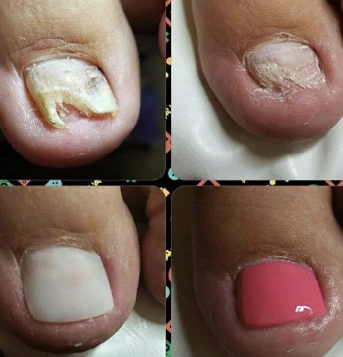 Images Foot and Toe on the Go CMT Services