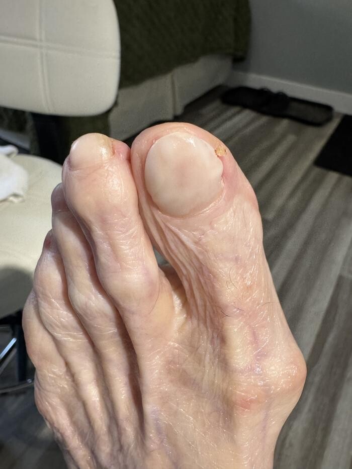 Images Foot and Toe on the Go CMT Services