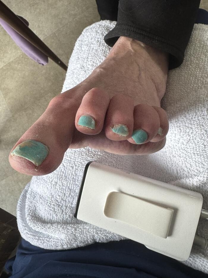 Images Foot and Toe on the Go CMT Services