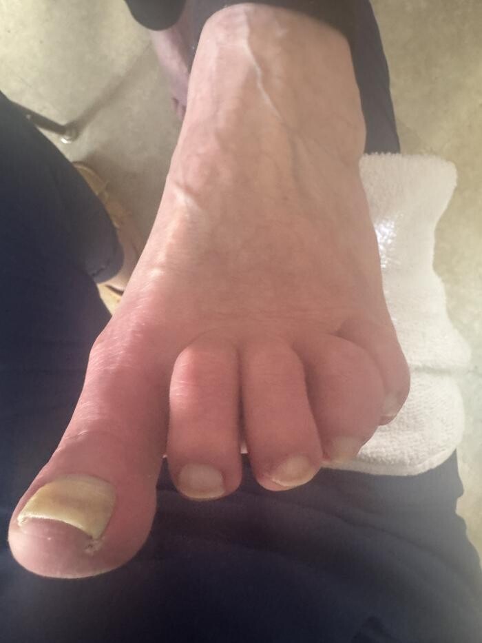 Images Foot and Toe on the Go CMT Services