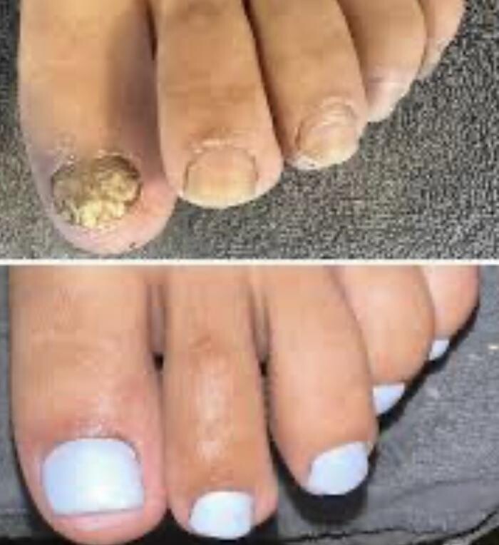 Images Foot and Toe on the Go CMT Services