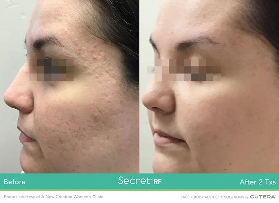 Images Victoria Skin Care Centre