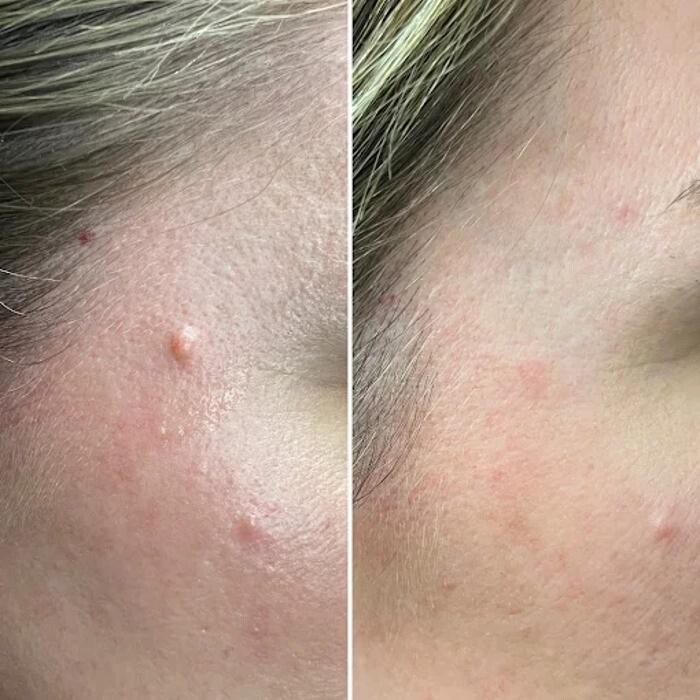 Images Victoria Skin Care Centre