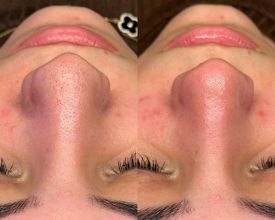 Images Reva Facials