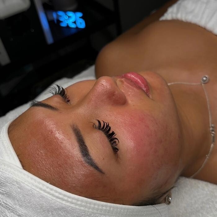 Images Reva Facials