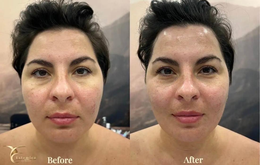 Images Estemica Esthetic