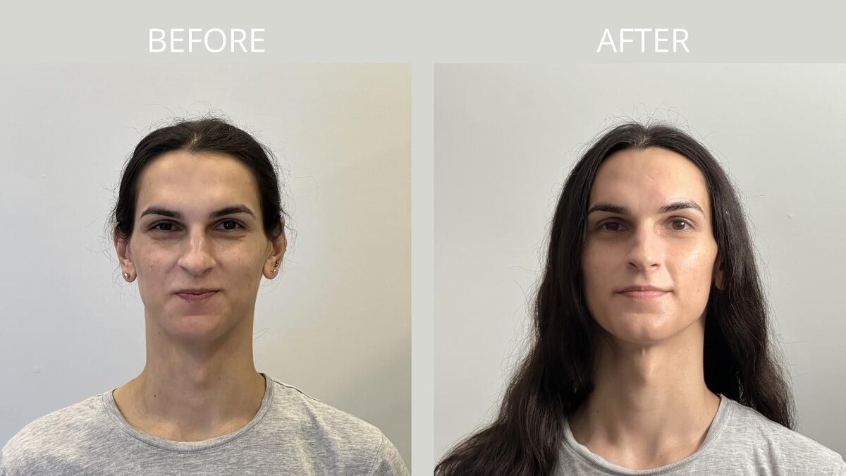 Images Estemica Esthetic