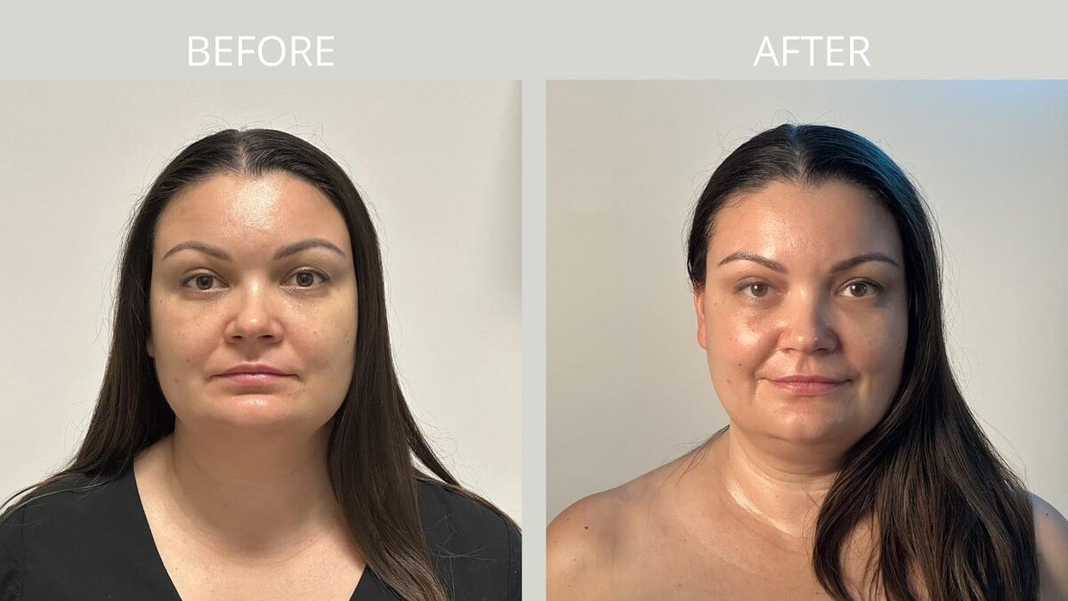 Images Estemica Esthetic