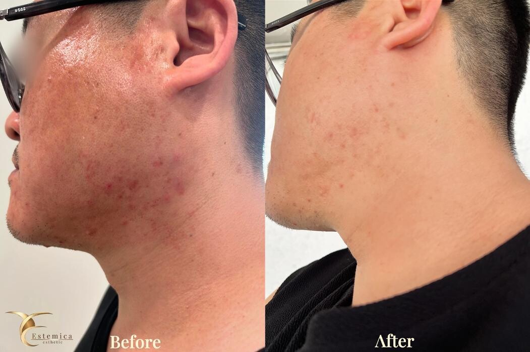 Images Estemica Esthetic