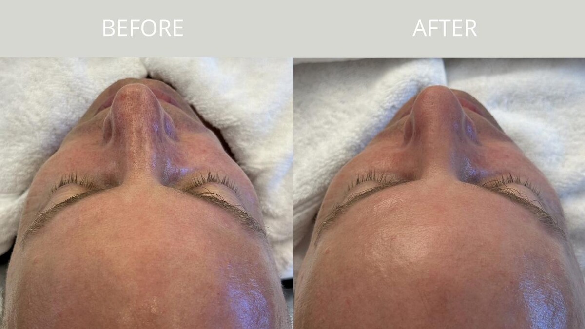 Images Estemica Esthetic